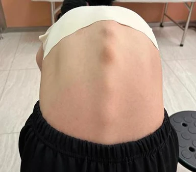 Revolutionizing Spinal Health: Xianku 3D Body Scanner